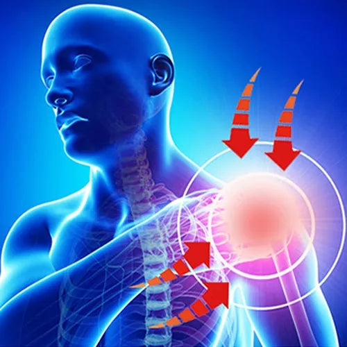 AliviaMax® Hombrera